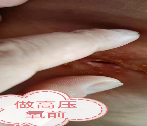 图片1 图片1.png
