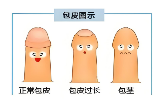 寿县人民医院泌尿外科包皮宣传2217 寿县人民医院泌尿外科包皮宣传2217.png